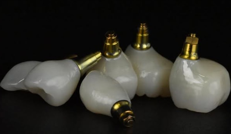 Implant Work 4