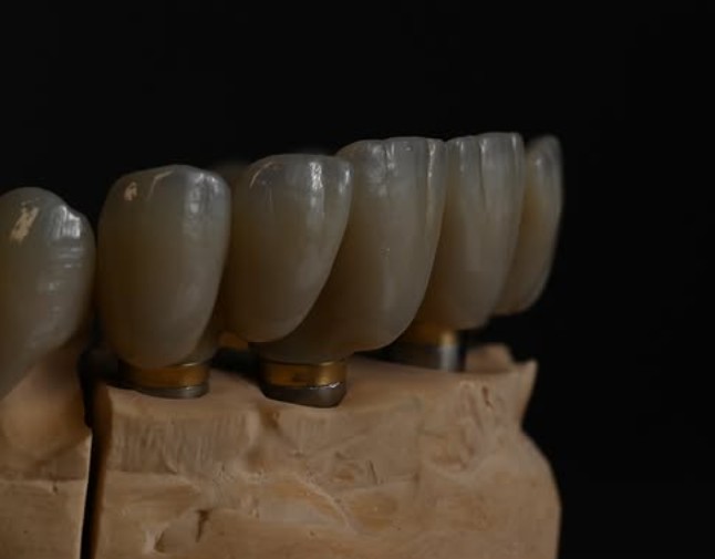 Metal Ceramic Work 2