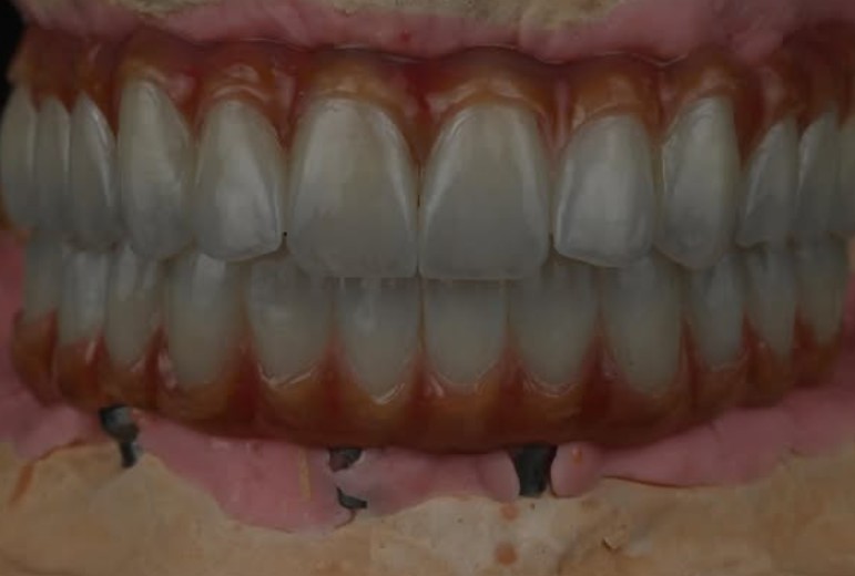 Provisional Work 4