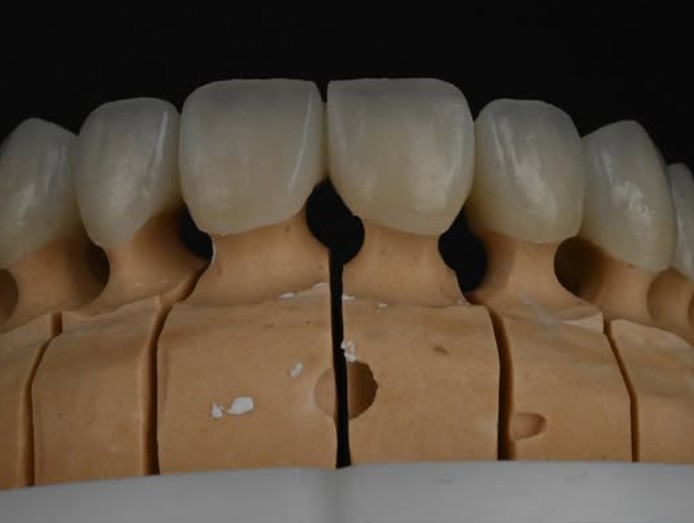 Zirconia / Zircon Ceramic 4